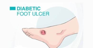 diabetic foot ulcer