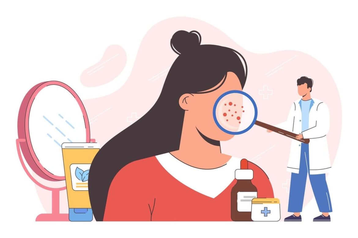 pcos-and-acne pcos acne pimples care